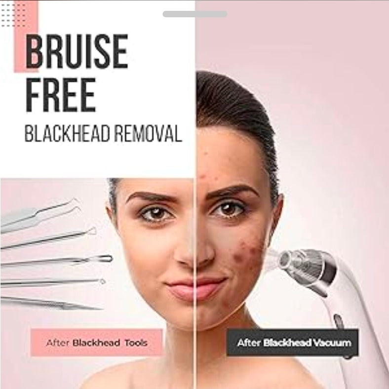 NWT The Good Stuff Blackhead Remover Travel Case